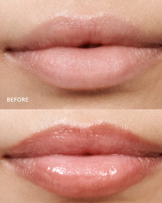 Hagelslag Lip Volumiser Arnhem