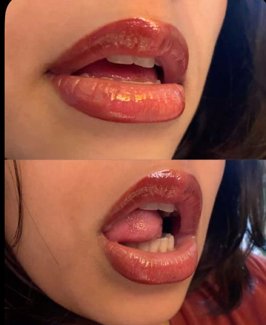 HAGELSLAG  Collection #1