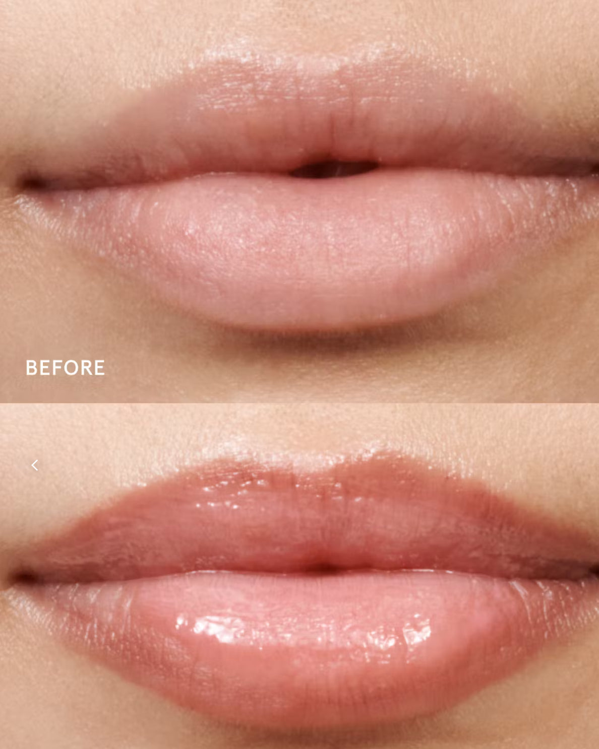 Hagelslag Lip Volumiser Arnhem