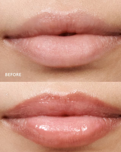 Hagelslag Lip Volumiser Arnhem